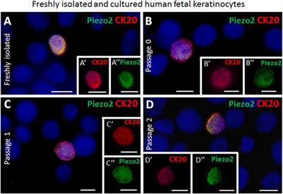 Human fetal skin derived merkel cells display distinctive characteristics in vitro and in bio-engineered skin substitutes in vivo